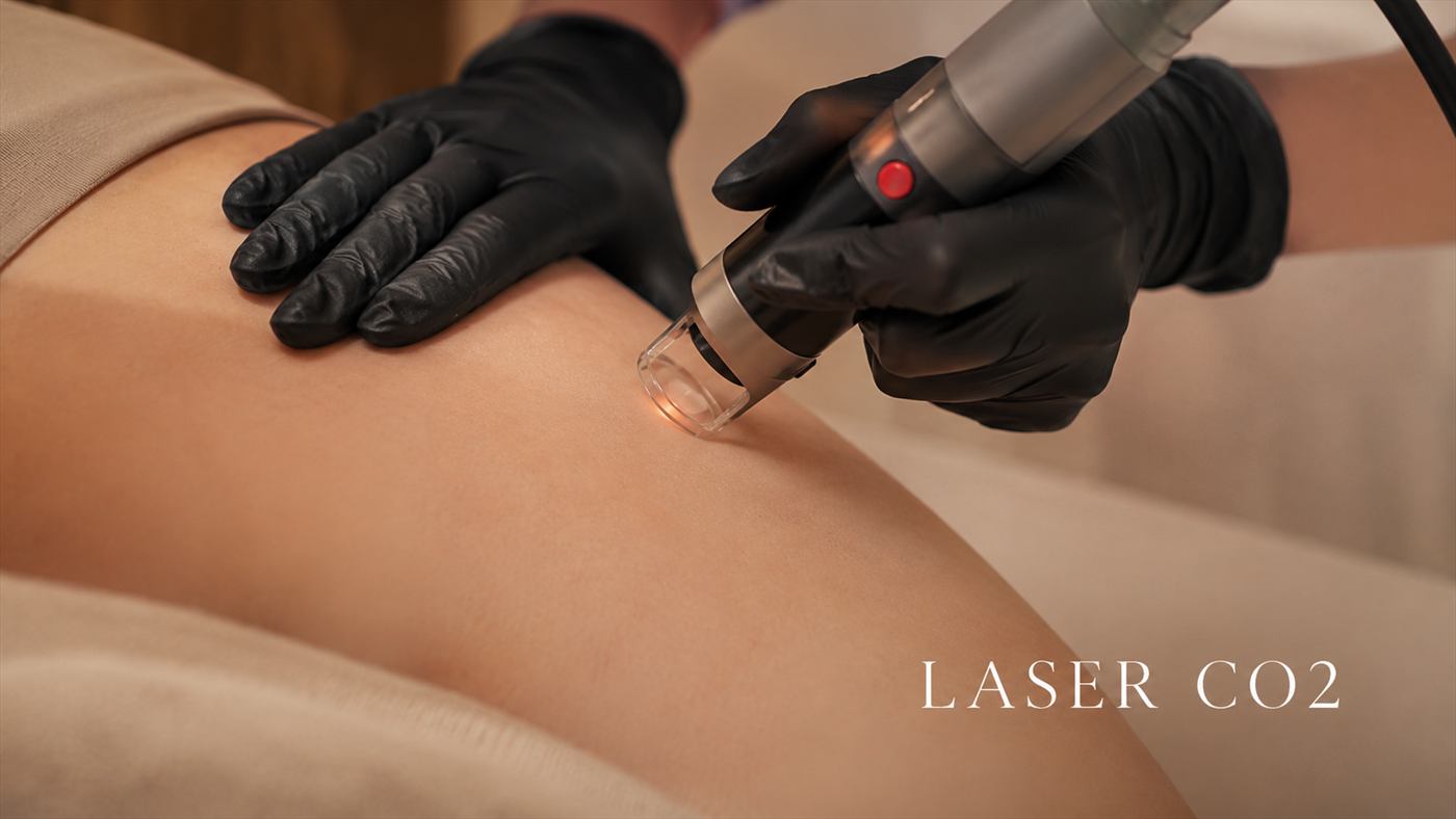 Tratament Laser CO2 intr-un cadru medical