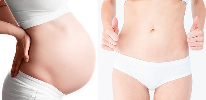 Estetică postnatală la ZEN Clinics București