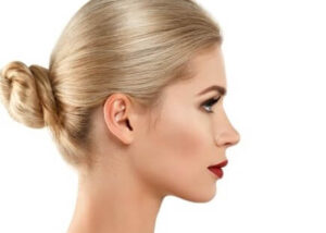 Rinoplastie